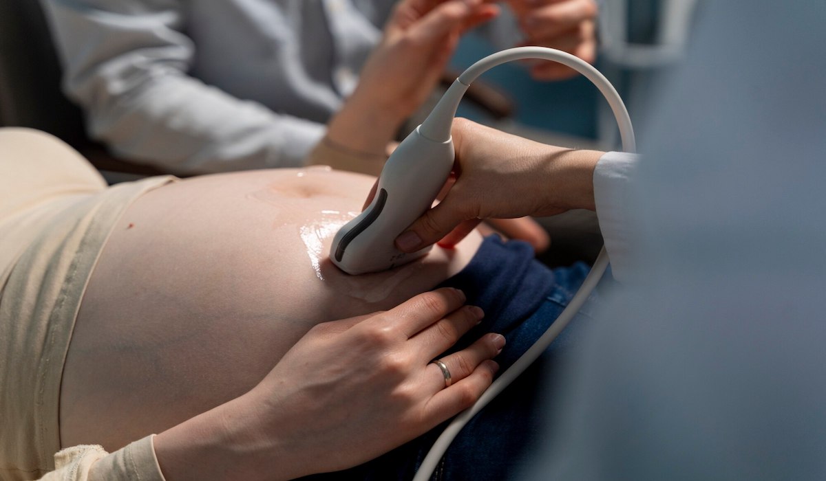 Mengenal Metode Mild Stimulation dalam Program IVF Tingkatkan Peluang Kehamilan