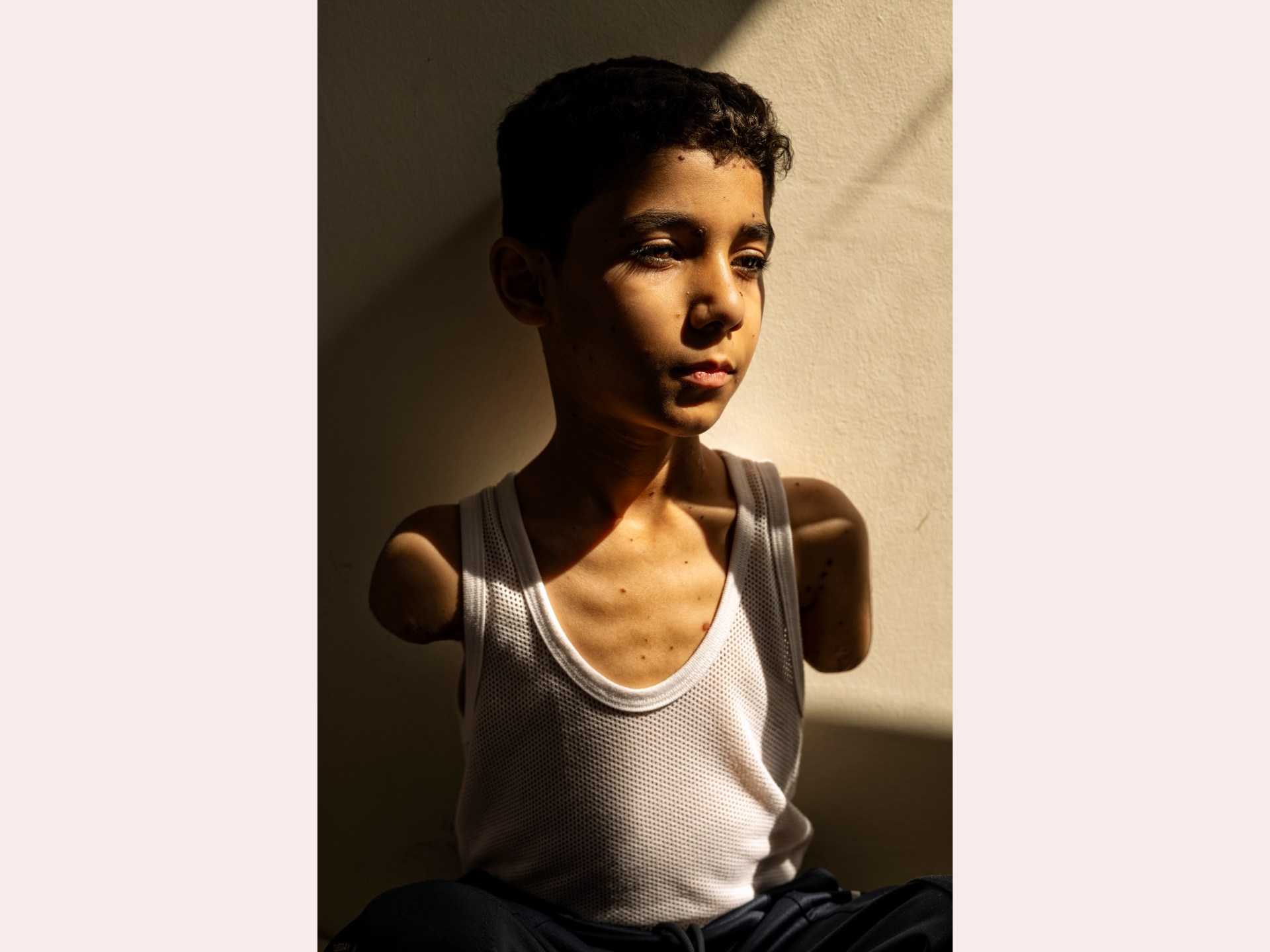 Potret Amputee Palestina Boy dari Gaza Wins World Press Photo Award | Berita Konflik Israel-Palestina